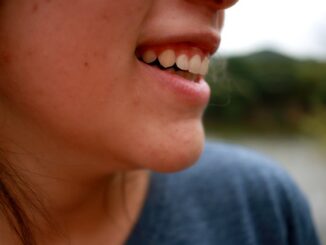 How to Get Acne-Free Skin in 6 Easy Steps