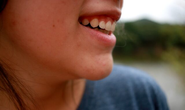 How to Get Acne-Free Skin in 6 Easy Steps